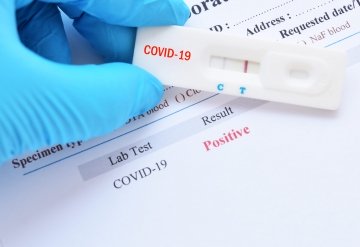 Экспресс-тест на антитела к COVID-19